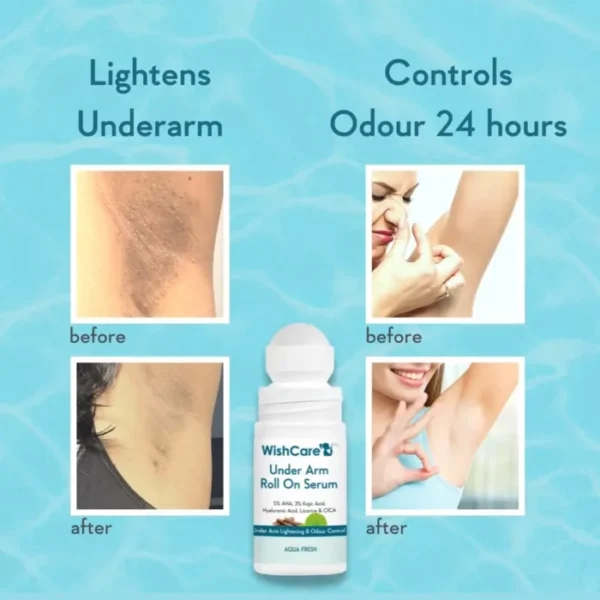 WISHCARE Under Arm Roll On Serum